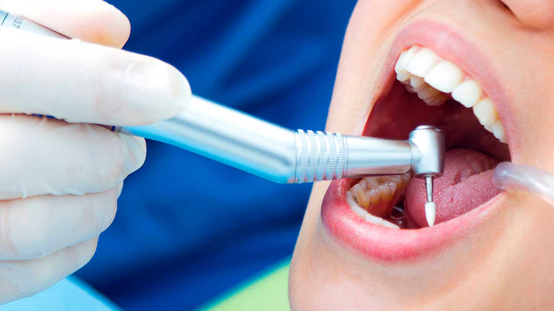 Imagen slider prueba